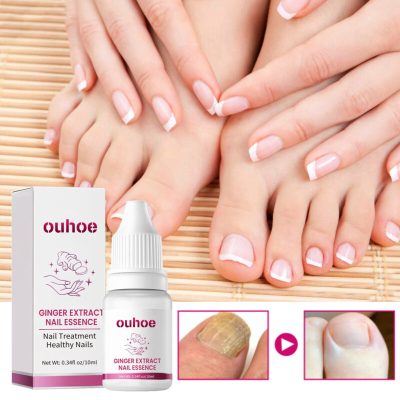 Moisturizing And Nourishing Nail Ginger Care Essence